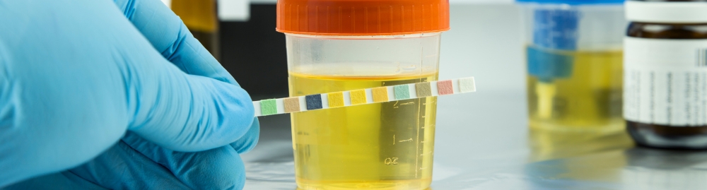 infecção nos rins aparece no exame de urina1.jpg