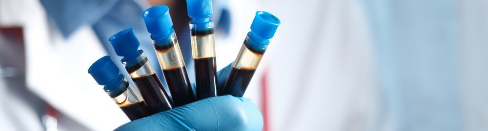 leucemia aparece no hemograma1.jpg