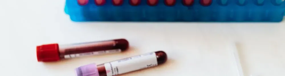 leucograma alterado​1.webp