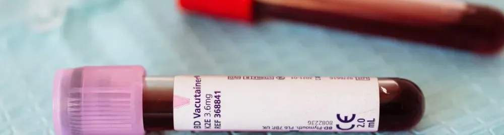 leucograma normal​1.webp