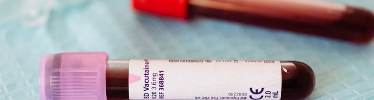Sangue grosso: o que significa? Causas, sintomas e riscos
