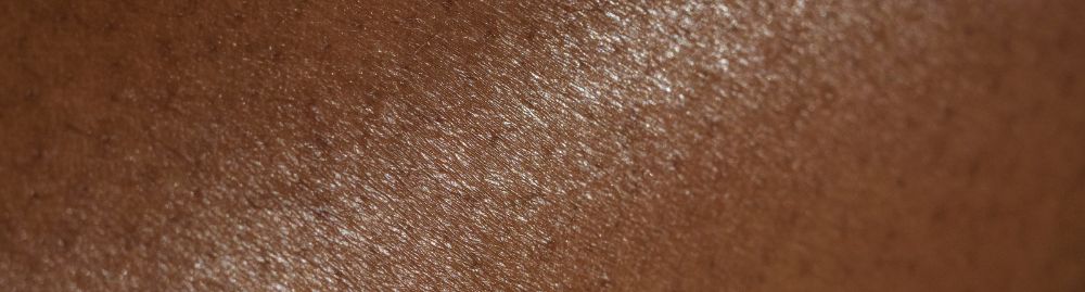 micose na virilha pele negra​1.jpg