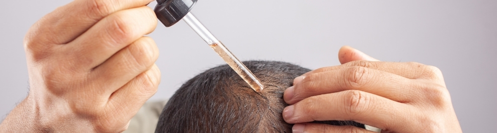 minoxidil serve para sobrancelha1.jpg