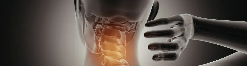 neoplasia cervical1.webp