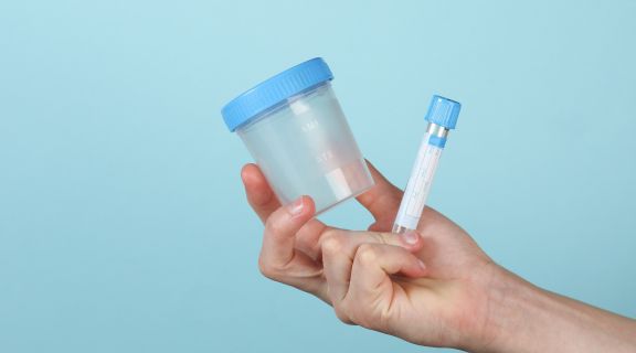 O que altera na urina quando está grávida? Entenda o que pode ser as alterações