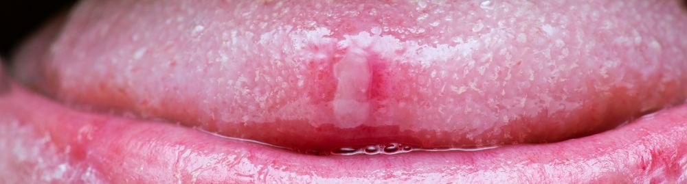 o que causa aftas na língua_1.jpg