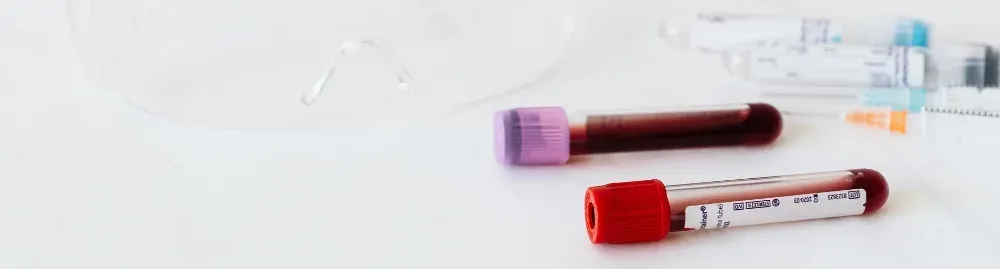 o que causa as plaquetas baixas1.webp