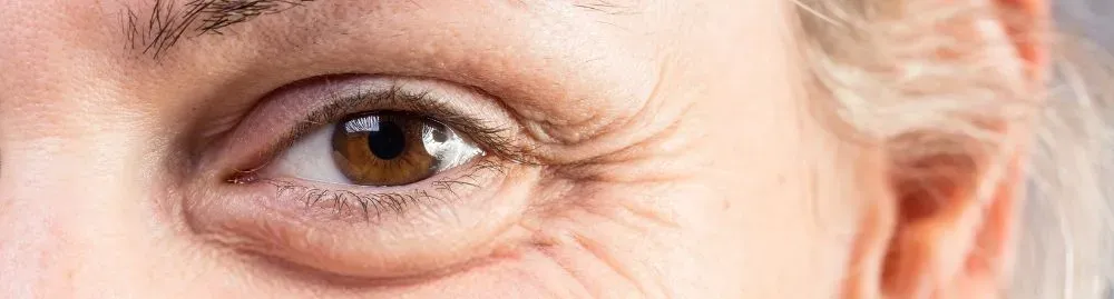 o que causa as rugas1.webp