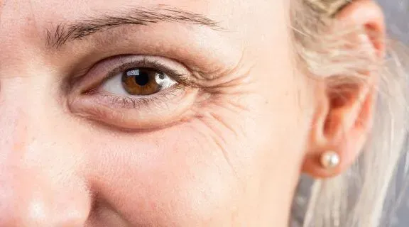 O que causa as rugas? Um guia completo sobre envelhecimento da pele