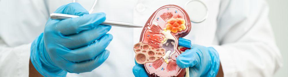 o que causa infecção no rim1.jpg