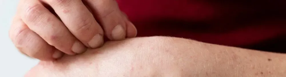 o que causa o pano branco_1.webp