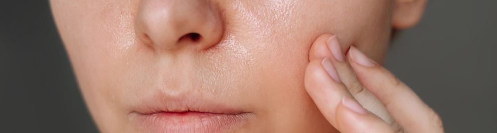 o que causa oleosidade na pele1.jpg