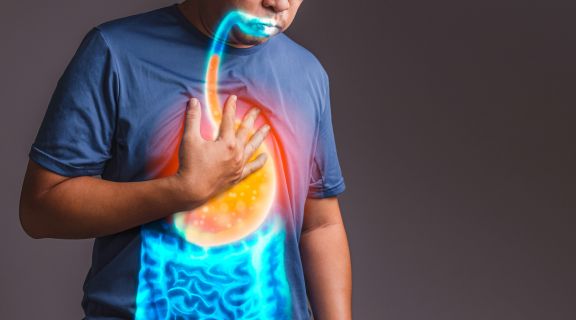 O que causa refluxo em adulto? Veja hábitos que podem prevenir o quadro