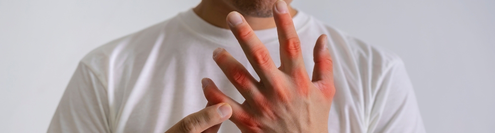 o que é ácido úrico no sangue1.jpg