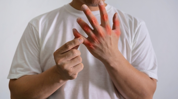O que é ácido úrico no sangue e por que seus níveis no sangue importam?