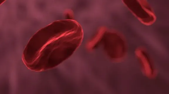Anemia hemolítica: entenda por que os glóbulos vermelhos são destruídos