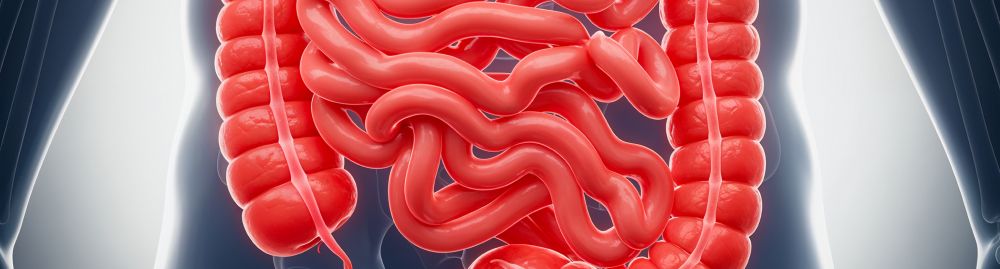 o que é câncer de cólon1.jpg