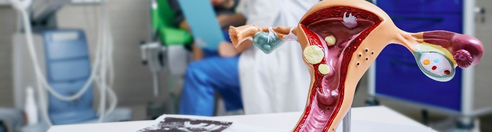 o que é colpocitologia oncótica_1.jpg