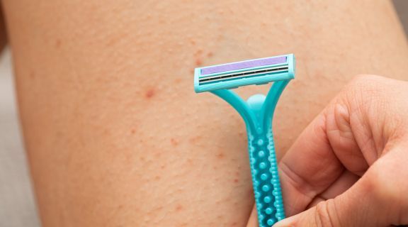 Foliculite na virilha: o que é, causas e como cuidar da pele inflamada