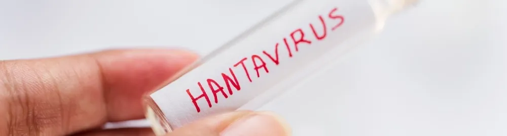 o que é hantavírus​1.webp