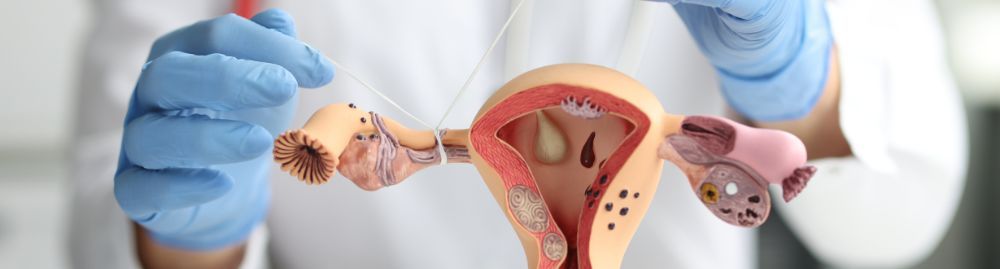 o que é laqueadura tubária1.jpg