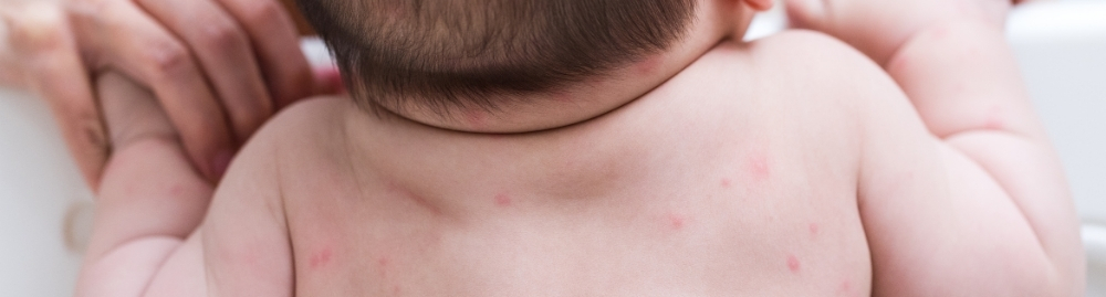 o que é meningite meningocócica1.jpg