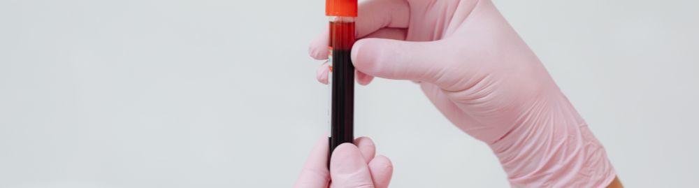 o que fazer para baixar o cortisol​1.jpg