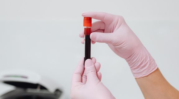 O que fazer para baixar o cortisol​: tudo o que você precisa saber