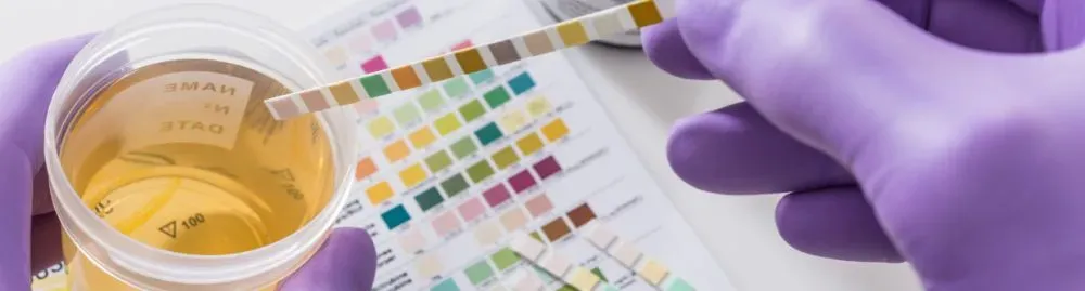 o que pode ser sangue na urina1.webp