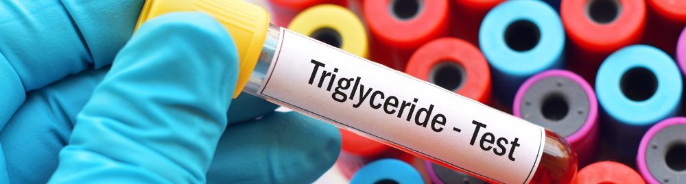 o que significa triglicerídeos1.jpg