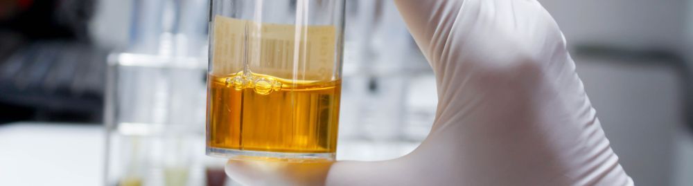 oxalato de cálcio na urina​1.jpg