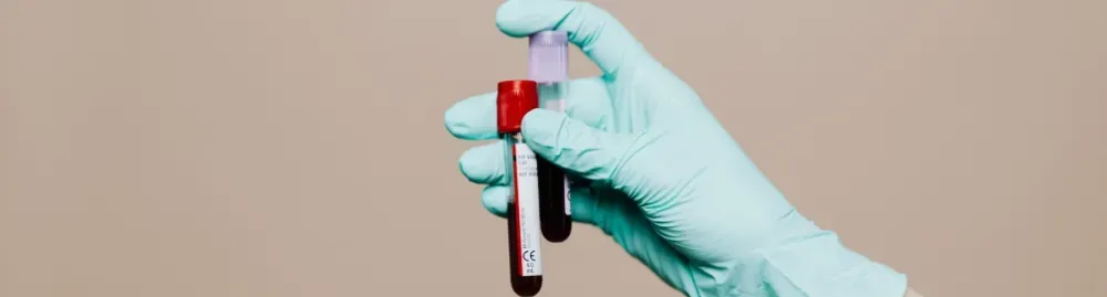 para que serve o exame pcr1.jpg