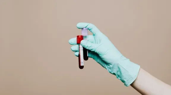 Para que serve o exame PCR? Entenda quando e por que fazer esse exame