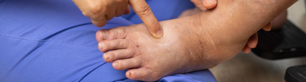 pé diabético tratamento_1.jpg