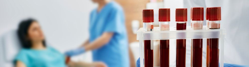 pode fumar antes de fazer exame de sangue1.jpg