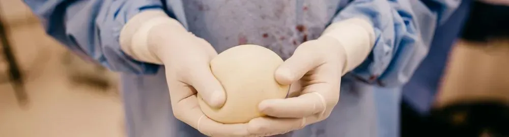 prótese de silicone pode causar câncer de mama1.webp