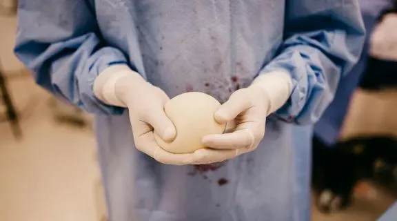 Prótese de silicone pode causar câncer de mama? Entenda a relação