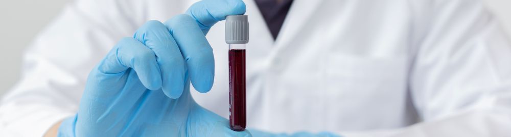 quais exames não precisam de pedido médico​1.jpg