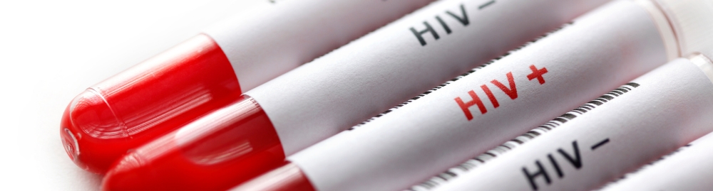 qual a diferença entre hiv e aids1.jpg