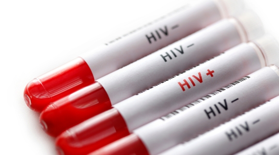 Qual a diferença entre HIV e AIDS? Veja os sintomas e como se prevenir
