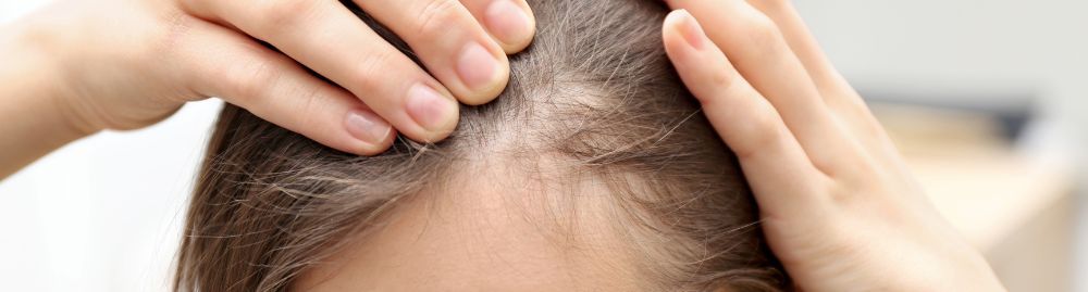 qual a melhor biotina para queda de cabelo​1.jpg