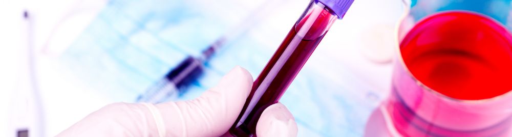 qual exame de sangue detecta esclerose múltipla1.jpg