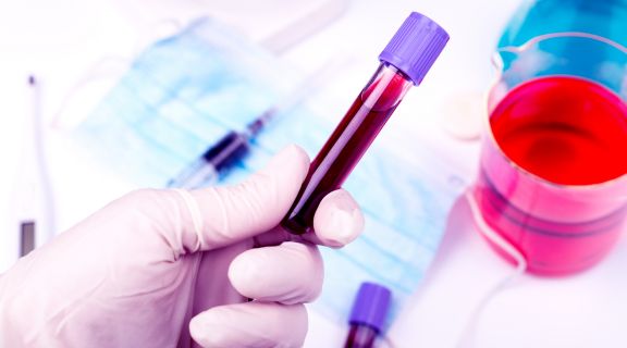 Qual exame de sangue detecta esclerose múltipla? Veja quando fazer