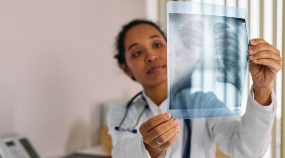 Qual exame detecta câncer de pulmão? Entenda como é feito o diagnóstico