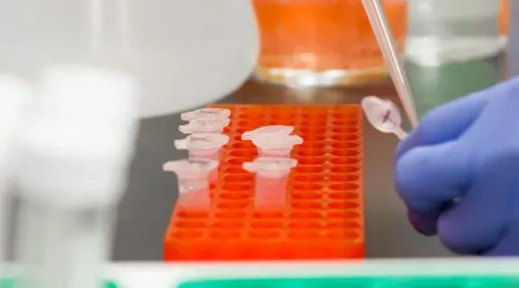 Qual exame detecta gonorreia: veja quais são os que detectam a IST