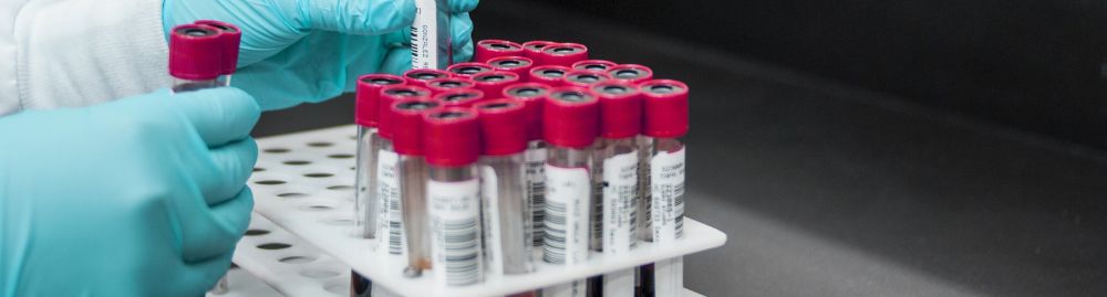 qual exame detecta insuficiência renal1.jpg