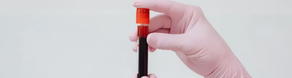 qual exame detecta menopausa1.webp