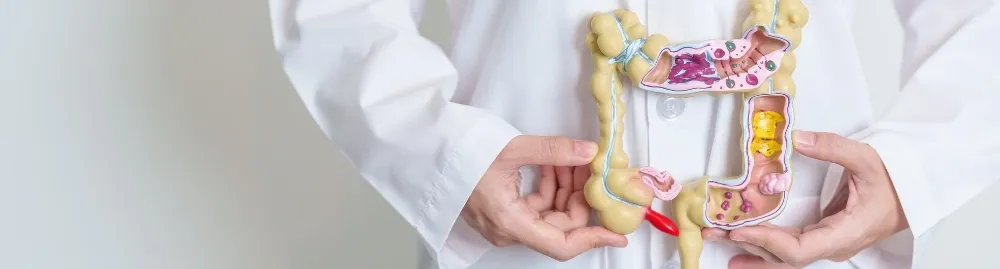qual o sintoma de câncer no intestino1.webp