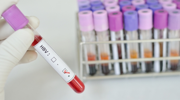 Qual o tratamento para hepatite B? Entenda as opções e como funcionam