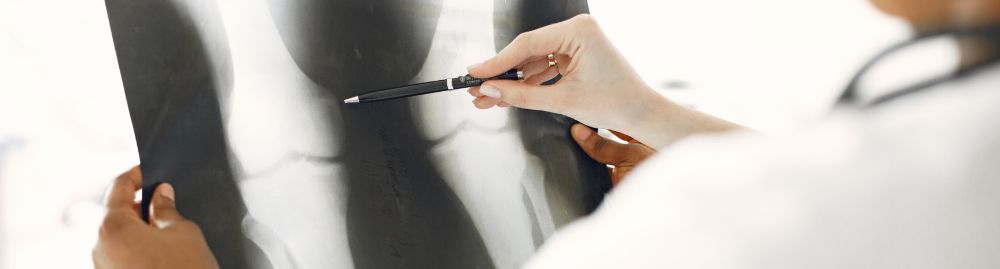 quando a osteoporose é grave​1.jpg